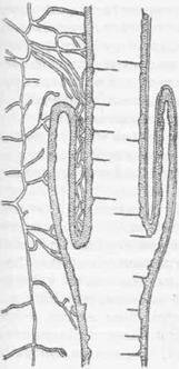 Рис. 64              Продольный разрез киш-ки при инвагинации