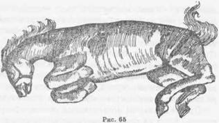 Рис. 66 Колики. Ущемление тощей кишки в паховом кольце