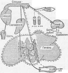 Рис. 69 Паренхиматозная (смешанная билирубино- уробилиновая) желтуха (по Домрачеву)
