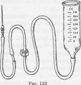 Цилиндр для вливания раствора в вену