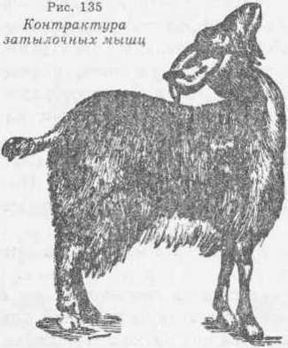 Контрактура затылочных мышц