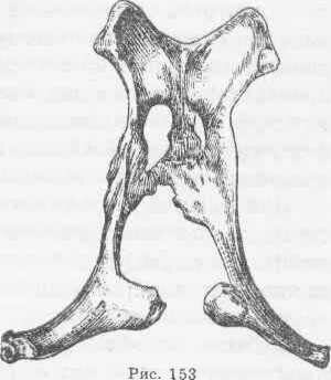 Кости таза коровы при алиментарной остеодистрофии Искривление лонной и седалищной костей с косой постановкой запирательного отверстия; левый внутренний угол подвздошной кости опустился.