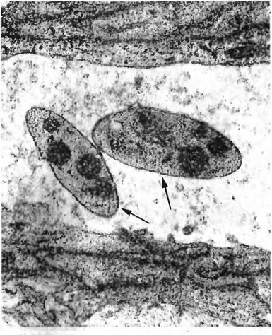 . 23. Rickettsia conjunctivae bovis ( )   .  ( . . )