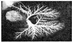 Рис. 1.б Ангиограмма легочной артерии собаки: