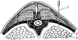 . 13.          . . :